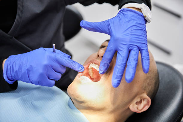 Best Emergency Dental Care for Broken or Chipped Teeth in Bidwell, OH