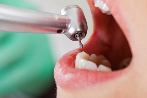 Best Cosmetic Emergency Dentistry in Bidwell, OH